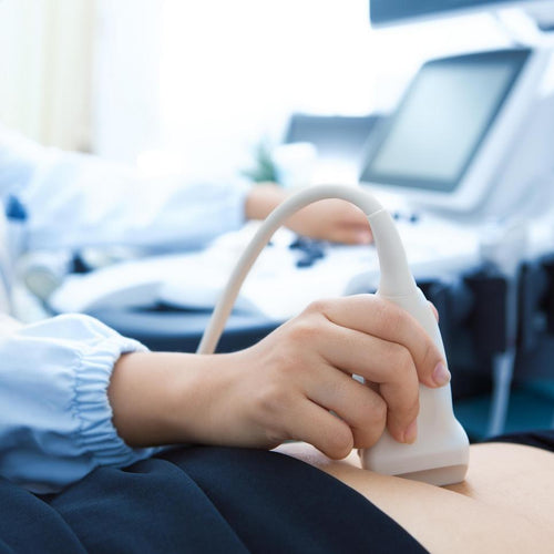 Una prueba con monitor de una mujer embarazada. - solucionesbanohub.compaña - 1