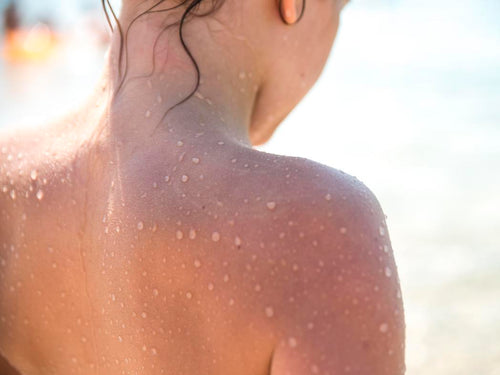 foto de una piel mojada bajo el sol. ¿por qué la piel de los niños es más sensible al sol? - solucionesbanohub.compaña - 1